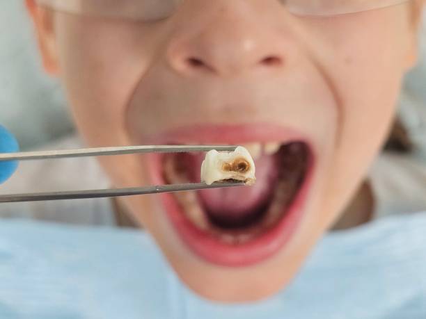 Best Weekend Emergency Dentist in Pevely, MO